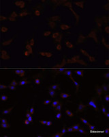 Immunofluorescence analysis of NIH/3T3 cells using NRF2 Polyclonal Antibody at dilution of 1:100. Blue: DAPI for nuclear staining.