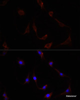 Immunofluorescence analysis of PC12 cells using NRF2 Polyclonal Antibody at dilution of 1:100. Blue: DAPI for nuclear staining.