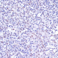 Immunohistochemistry of paraffin-embedded Human tonsil using NFKB1 Polyclonal Antibody at dilution of 1:200 (40x lens) .