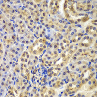 Immunohistochemistry of paraffin-embedded Mouse kidney using IKB alpha Polyclonal Antibody at dilution of 1:100 (40x lens) .
