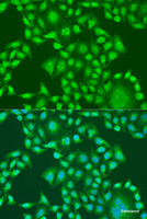 Immunofluorescence analysis of U2OS cells using PTEN Polyclonal Antibody at dilution of 1:100. Blue: DAPI for nuclear staining.