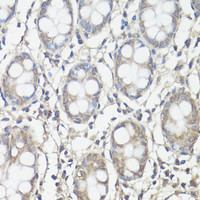 Immunohistochemistry of paraffin-embedded Human colon using FAK Polyclonal Antibody at dilution of 1:100 (40x lens) .