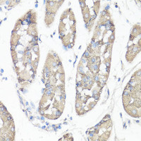 Immunohistochemistry of paraffin-embedded Human stomach using FAK Polyclonal Antibody at dilution of 1:100 (40x lens) .