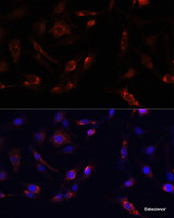 Immunofluorescence analysis of PC12 cells using FAK Polyclonal Antibody at dilution of 1:100. Blue: DAPI for nuclear staining.