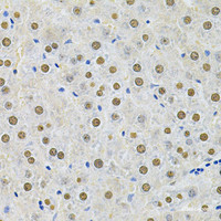 Immunohistochemistry of paraffin-embedded Rat liver using SQSTM1 / p62 Polyclonal Antibody at dilution of 1:200 (40x lens) .