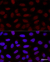 Confocal immunofluorescence analysis of U2OS cells using YAP1 Polyclonal Antibody at dilution of 1:200. Blue: DAPI for nuclear staining.