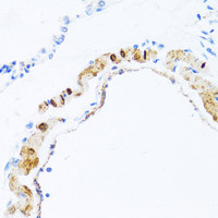 Immunohistochemistry of paraffin-embedded Rat lung using PHPT1 Polyclonal Antibody at dilution of 1:100 (40x lens) .