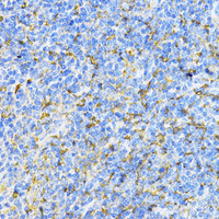 Immunohistochemistry of paraffin-embedded Mouse spleen using PD-L1 Polyclonal Antibody at dilution of 1:100 (40x lens) .