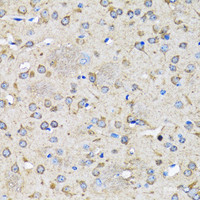 Immunohistochemistry of paraffin-embedded Rat brain using LC3B Polyclonal Antibody at dilution of 1:100 (40x lens) .