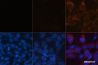 Immunofluorescence analysis of LC3B knockout 293T cells treated by chloroquine (top left) and wild-type 293T cells (top middle) ，wild-type 293T cells treated by chloroquine (top right) using LC3B Polyclonal Antibody at dilution of 1:100. Blue: DAPI for nuclear staining.