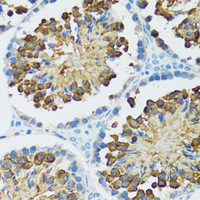 Immunohistochemistry of paraffin-embedded Rat testis using Caspase-3 Polyclonal Antibody at dilution of 1:100 (40x lens) .