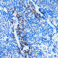 Immunohistochemistry of paraffin-embedded Rat spleen using Caspase-3 Polyclonal Antibody at dilution of 1:100 (40x lens) .