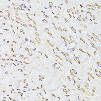 Immunohistochemistry of paraffin-embedded Human uterus using EMD Polyclonal Antibody at dilution of 1:100 (40x lens) .