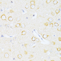 Immunohistochemistry of paraffin-embedded Rat brain using Caspase-8 Polyclonal Antibody at dilution of 1:100 (40x lens) .