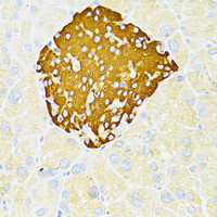 Immunohistochemistry of paraffin-embedded Mouse pancreatic islets using DDIT3 / CHOP Polyclonal Antibody at dilution of 1:100 (40x lens) .