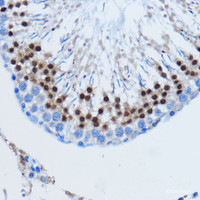 Immunohistochemistry of paraffin-embedded Rat testis using DDIT3 / CHOP Polyclonal Antibody at dilution of 1:100 (40x lens) .