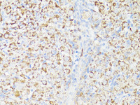 Immunohistochemistry of paraffin-embedded Rat ovary using mTOR Polyclonal Antibody at dilution of 1:150 (40x lens) .