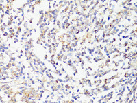 Immunohistochemistry of paraffin-embedded Human tonsil using mTOR Polyclonal Antibody at dilution of 1:150 (40x lens) .