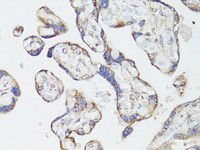 Immunohistochemistry of paraffin-embedded Human placenta using mTOR Polyclonal Antibody at dilution of 1:150 (40x lens) .