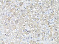 Immunohistochemistry of paraffin-embedded Mouse liver using mTOR Polyclonal Antibody at dilution of 1:150 (40x lens) .