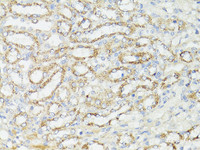 Immunohistochemistry of paraffin-embedded Mouse kidney using mTOR Polyclonal Antibody at dilution of 1:150 (40x lens) .