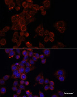 Immunofluorescence analysis of HeLa cells using mTOR Polyclonal Antibody at dilution of 1:100. Blue: DAPI for nuclear staining.