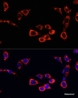 Immunofluorescence analysis of NIH/3T3 cells using mTOR Polyclonal Antibody at dilution of 1:100. Blue: DAPI for nuclear staining.