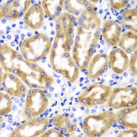 Immunohistochemistry of paraffin-embedded Mouse kidney using IRF3 Polyclonal Antibody at dilution of 1:100 (40x lens) .