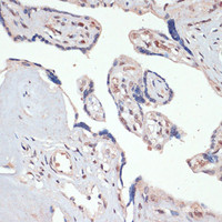 Immunohistochemistry of paraffin-embedded Human placenta using c-Jun Polyclonal Antibody at dilution of 1:100 (40x lens) .