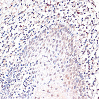 Immunohistochemistry of paraffin-embedded Human tonsil using c-Jun Polyclonal Antibody at dilution of 1:100 (40x lens) .
