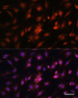 Immunofluorescence analysis of C6 cells using c-Jun Polyclonal Antibody at dilution of 1:100. Blue: DAPI for nuclear staining.