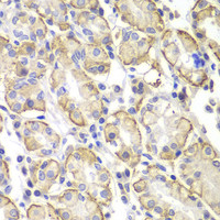 Immunohistochemistry of paraffin-embedded Human stomach using Lyn Polyclonal Antibody at dilution of 1:100 (40x lens) .