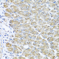 Immunohistochemistry of paraffin-embedded Mouse stomach using RAC2 Polyclonal Antibody at dilution of 1:100 (40x lens) .