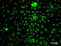 Immunofluorescence analysis of HeLa cells using Ki67 Polyclonal Antibody