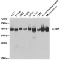 Western blot analysis of extracts of various cell lines using ALDOA Polyclonal Antibody at dilution of 1:1000.