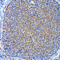 Immunohistochemistry of paraffin-embedded Rat ovary using MAP1LC3A Polyclonal Antibody at dilution of 1:100 (40x lens) .