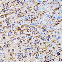 Immunohistochemistry of paraffin-embedded Rat brain using MAP1LC3A Polyclonal Antibody at dilution of 1:100 (40x lens) .