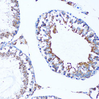 Immunohistochemistry of paraffin-embedded Mouse testis using MAP1LC3A Polyclonal Antibody at dilution of 1:100 (20x lens) .