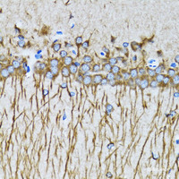 Immunohistochemistry of paraffin-embedded Mouse brain using MAP1LC3A Polyclonal Antibody at dilution of 1:100 (40x lens) .
