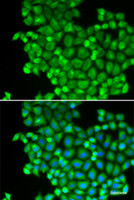 Immunofluorescence analysis of A549 cells using LDHA Polyclonal Antibody