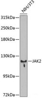 Western blot analysis of extracts of NIH/3T3 cells using JAK2 Polyclonal Antibody at dilution of 1:1000.