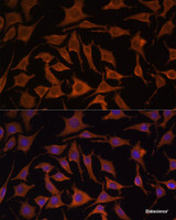 Immunofluorescence analysis of L929 cells using TNF-α Polyclonal Antibody at dilution of 1:100. Blue: DAPI for nuclear staining.