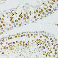 Immunohistochemistry of paraffin-embedded Rat testis using BRCA1 Polyclonal Antibody at dilution of 1:100 (40x lens) .