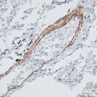 Immunohistochemistry of paraffin-embedded Human lung using TPM1 Polyclonal Antibody at dilution of 1:100 (40x lens) .