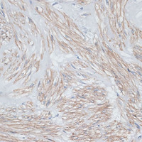 Immunohistochemistry of paraffin-embedded Human uterus using TPM1 Polyclonal Antibody at dilution of 1:100 (40x lens) .