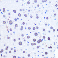 Immunohistochemistry of paraffin-embedded Mouse liver using CHD4 Polyclonal Antibody at dilution of 1:100 (40x lens) .