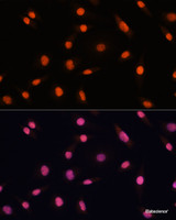 Immunofluorescence analysis of L929 cells using CHD4 Polyclonal Antibody at dilution of 1:100. Blue: DAPI for nuclear staining.