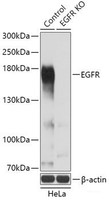 Western blot analysis of extracts from normal (control) and EGFR knockout (KO) HeLa cells using EGFR Polyclonal Antibody at dilution of 1:3000.