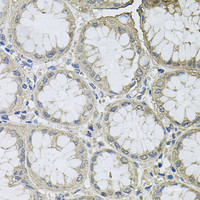 Immunohistochemistry of paraffin-embedded Human stomach using BCL2L2 Polyclonal Antibody at dilution of 1:100 (40x lens) .