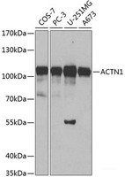 Western blot analysis of extracts of various cell lines using ACTN1 Polyclonal Antibody at dilution of 1:500.